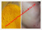 Polvos esteroides crudos/Isotretinoin para los cánceres de piel, CAS 4759-48-2 del color amarillo proveedor